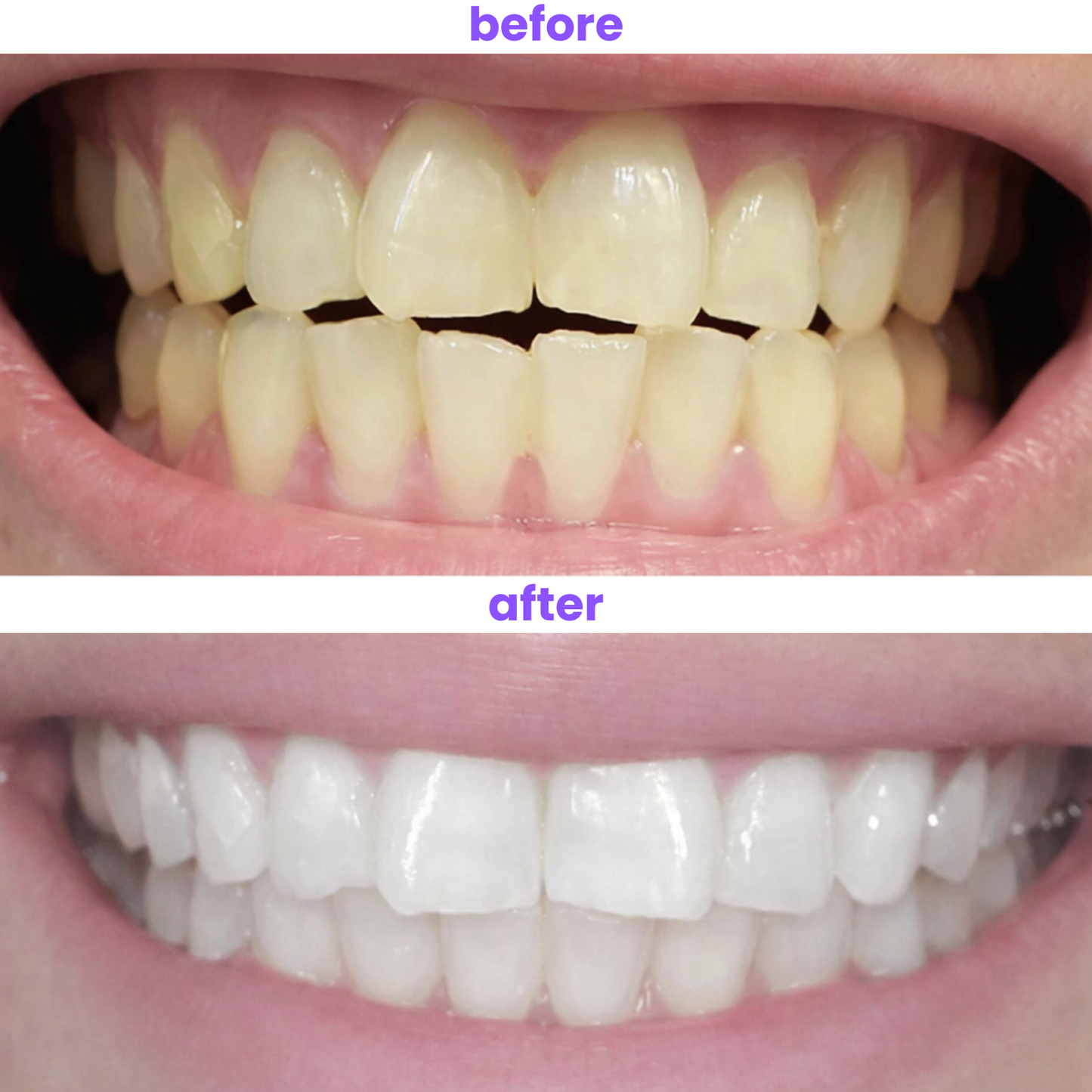 Formula 27 Whitening Tablets